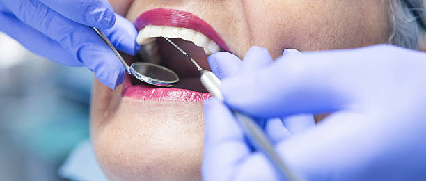 Best Emergency Wisdom Teeth Removal in Mountain Green, UT